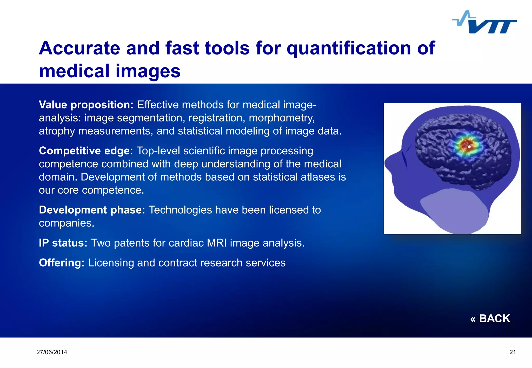 Click to edit Master title style
 Click to edit Master text styles
 Second level
 Third level
 Fourth level
 Fifth level
2127/06/2014 21
Accurate and fast tools for quantification of
medical images
Value proposition: Effective methods for medical image-
analysis: image segmentation, registration, morphometry,
atrophy measurements, and statistical modeling of image data.
Competitive edge: Top-level scientific image processing
competence combined with deep understanding of the medical
domain. Development of methods based on statistical atlases is
our core competence.
Development phase: Technologies have been licensed to
companies.
IP status: Two patents for cardiac MRI image analysis.
Offering: Licensing and contract research services
« BACK
 