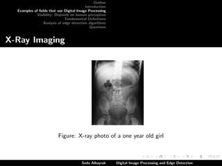 Outline
Introduction
Examples of ﬁelds that use Digital Image Processing
Visibility: Depends on human perception
Fundamental Deﬁnitions
Analysis of edge detection algorithms
Questions

X-Ray Imaging

Figure: X-ray photo of a one year old girl

Seda Albayrak

Digital Image Processing and Edge Detection

 