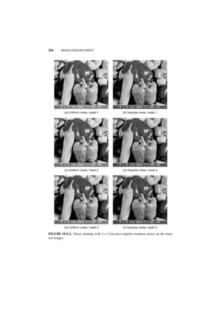 264     IMAGE ENHANCEMENT




          (a ) Uniform noise, mask 1               (b ) Impulse noise, mask 1




           (c ) Uniform noise, mask 2              (d ) Impulse noise, mask 2




          (e ) Uniform noise, mask 3               (f ) Impulse noise, mask 3

FIGURE 10.3-2. Noise cleaning with 3 × 3 low-pass impulse response arrays on the noisy
test images.
 