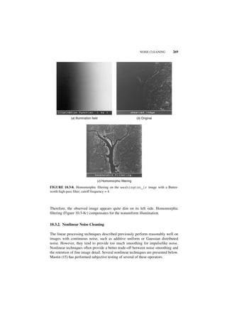 NOISE CLEANING   269




             (a) Illumination field                           (b) Original




                                  (c) Homomorphic filtering

FIGURE 10.3-8. Homomorphic filtering on the washington_ir image with a Butter-
worth high-pass filter; cutoff frequency = 4.



Therefore, the observed image appears quite dim on its left side. Homomorphic
filtering (Figure 10.3-8c) compensates for the nonuniform illumination.


10.3.2. Nonlinear Noise Cleaning

The linear processing techniques described previously perform reasonably well on
images with continuous noise, such as additive uniform or Gaussian distributed
noise. However, they tend to provide too much smoothing for impulselike noise.
Nonlinear techniques often provide a better trade-off between noise smoothing and
the retention of fine image detail. Several nonlinear techniques are presented below.
Mastin (15) has performed subjective testing of several of these operators.
 