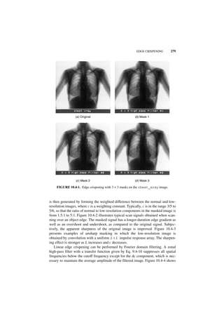 EDGE CRISPENING         279




                  (a ) Original                           (b) Mask 1




                  (c ) Mask 2                             (d ) Mask 3

     FIGURE 10.4-1. Edge crispening with 3 × 3 masks on the chest_xray image.



is then generated by forming the weighted difference between the normal and low-
resolution images, where c is a weighting constant. Typically, c is in the range 3/5 to
5/6, so that the ratio of normal to low-resolution components in the masked image is
from 1.5:1 to 5:1. Figure 10.4-2 illustrates typical scan signals obtained when scan-
ning over an object edge. The masked signal has a longer-duration edge gradient as
well as an overshoot and undershoot, as compared to the original signal. Subjec-
tively, the apparent sharpness of the original image is improved. Figure 10.4-3
presents examples of unsharp masking in which the low-resolution image is
obtained by convolution with a uniform L × L impulse response array. The sharpen-
ing effect is stronger as L increases and c decreases.
    Linear edge crispening can be performed by Fourier domain filtering. A zonal
high-pass filter with a transfer function given by Eq. 9.4-10 suppresses all spatial
frequencies below the cutoff frequency except for the dc component, which is nec-
essary to maintain the average amplitude of the filtered image. Figure 10.4-4 shows
 