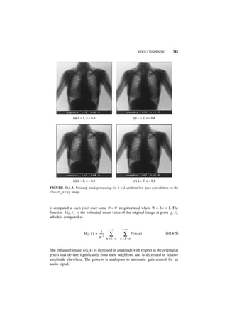 EDGE CRISPENING       281




               (a) L = 3, c = 0.6                                   (b) L = 3, c = 0.8




               (c) L = 7, c = 0.6                                  (d ) L = 7, c = 0.8

FIGURE 10.4-3. Unsharp mask processing for L × L uniform low-pass convolution on the
chest_xray image.



is computed at each pixel over some W × W neighborhood where W = 2w + 1. The
function M ( j, k ) is the estimated mean value of the original image at point (j, k),
which is computed as


                                               j+w       k+w
                                       1-
                       M ( j, k ) = -------
                                    W
                                          2     ∑         ∑       F ( m, n )              (10.4-5)
                                              m = j–w   n = k–w



The enhanced image G ( j, k ) is increased in amplitude with respect to the original at
pixels that deviate significantly from their neighbors, and is decreased in relative
amplitude elsewhere. The process is analogous to automatic gain control for an
audio signal.
 