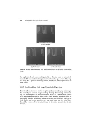 438     MORPHOLOGICAL IMAGE PROCESSING




                                  erosion profile 1 iteration
                                      (a ) One iteration




              erosion profile 2 iterations           erosion profile 3 iterations
                  (b ) Two iterations                    (c ) Three iterations

FIGURE 14.6-2. One-dimensional gray scale image erosion on a printed circuit board
image.



the amplitude of each corresponding pixel (i.e., the gray scale is subtractively
inverted). The translated structuring element then forms the open surface of the orig-
inal image. For a spherical structuring element, bright spots in the original image are
made darker.


14.6.3. Conditional Gray Scale Image Morphological Operators

There have been attempts to develop morphological operators for gray scale images
that are analogous to binary image shrinking, thinning, skeletonizing, and thicken-
ing. The stumbling block to these extensions is the lack of a definition for connec-
tivity of neighboring gray scale pixels. Serra (4) has proposed approaches based on
topographic mapping techniques. Another approach is to iteratively perform the
basic dilation and erosion operations on a gray scale image and then use a binary
thresholded version of the resultant image to determine connectivity at each
iteration.
 