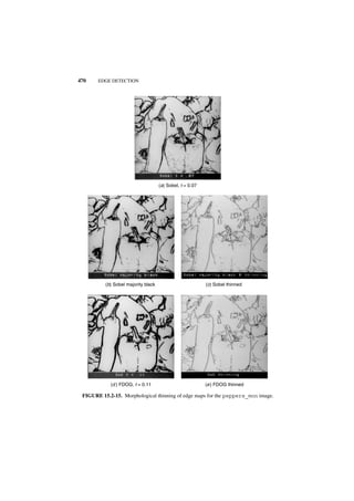 470    EDGE DETECTION




                                     (a) Sobel, t = 0.07




          (b) Sobel majority black                         (c) Sobel thinned




            (d ) FDOG, t = 0.11                            (e ) FDOG thinned

 FIGURE 15.2-15. Morphological thinning of edge maps for the peppers_mon image.
 