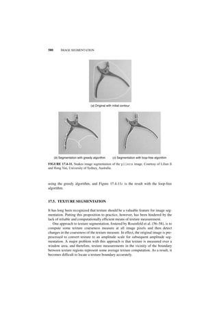 Digital image processing