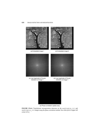 Digital image processing