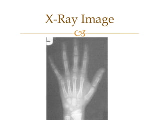 X-Ray Image
    
 