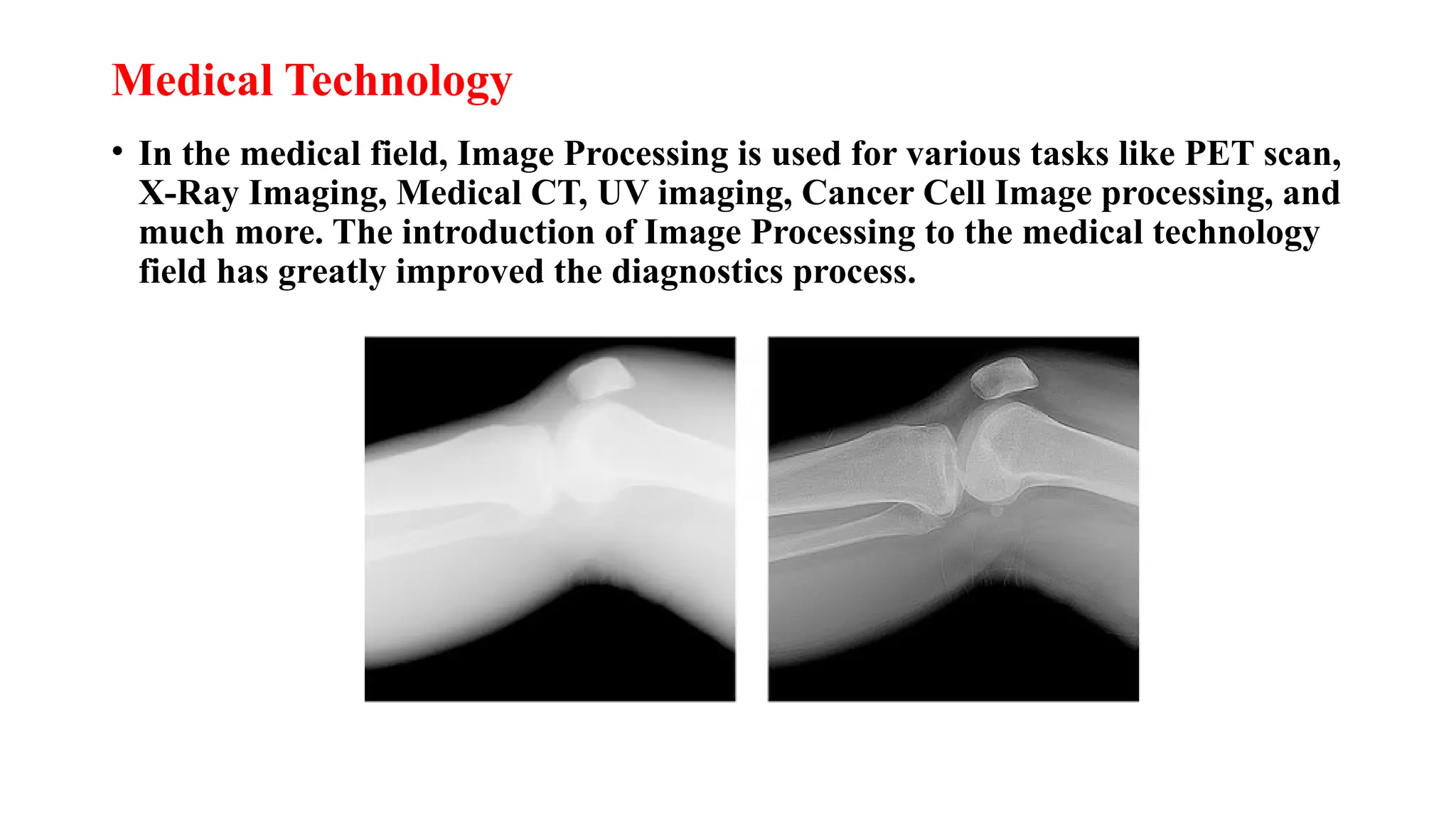 Medical Technology
• In the medical field, Image Processing is used for various tasks like PET scan,
X-Ray Imaging, Medical CT, UV imaging, Cancer Cell Image processing, and
much more. The introduction of Image Processing to the medical technology
field has greatly improved the diagnostics process.
 