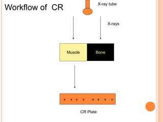 Muscle Bone
CR Plate
X-rays
X-ray tube
Workflow of CR
 