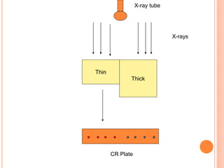 Thin
Thick
CR Plate
X-rays
X-ray tube
 