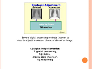 Several digital processing methods that can be
used to adjust the contrast characteristics of an image.
1.) Digital image correction,
2.)global processing,
3.)rotation,
4.)grey scale inversion.
5.) Windowing
 