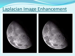 Laplacian Image Enhancement
 