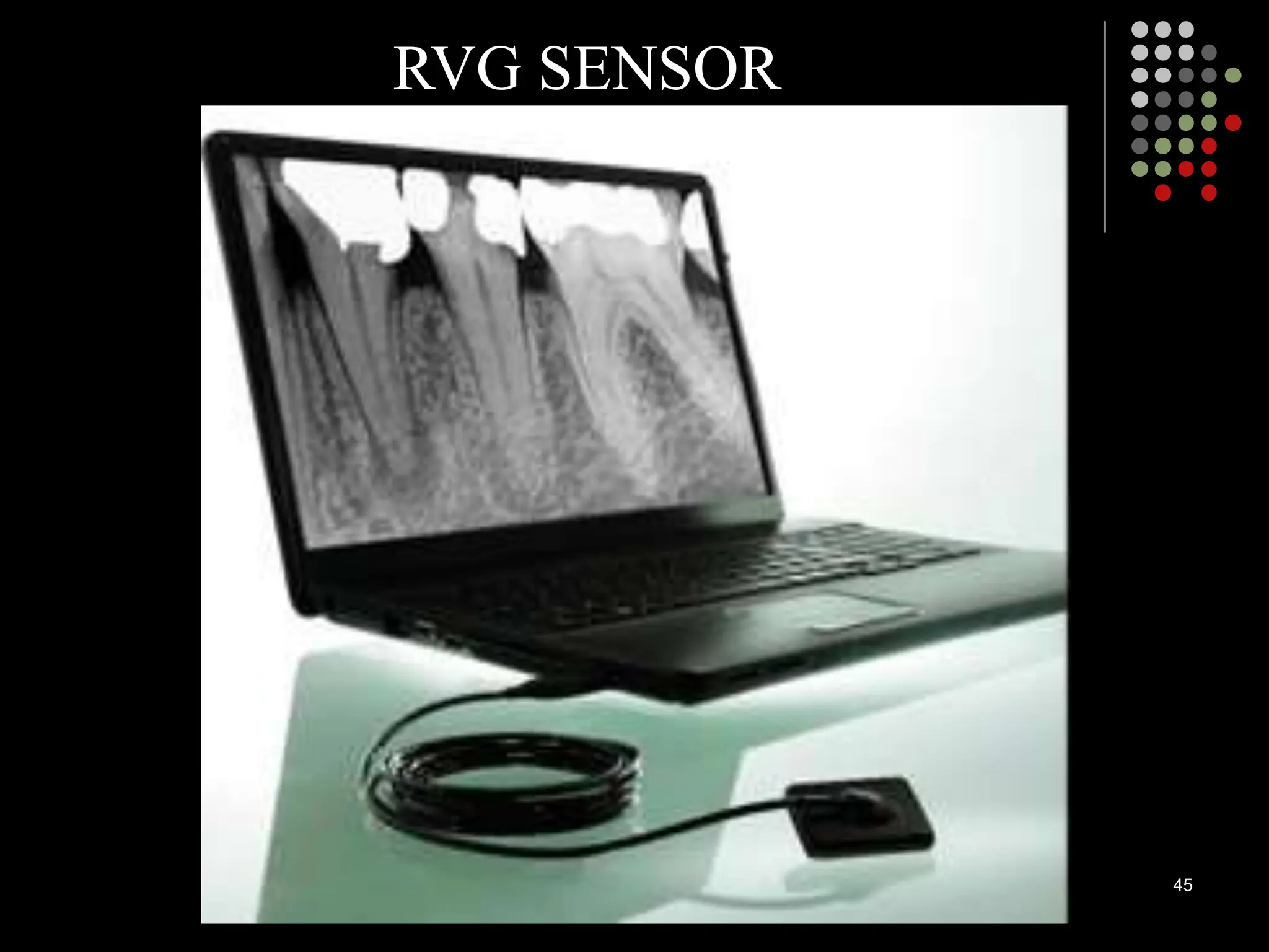 45
RVG SENSOR
 