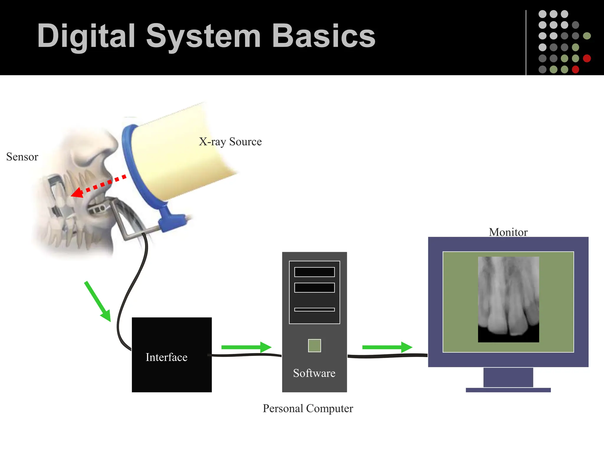 Digital System Basics
Interface
Monitor
Personal Computer
Software
X-ray Source
Sensor
 