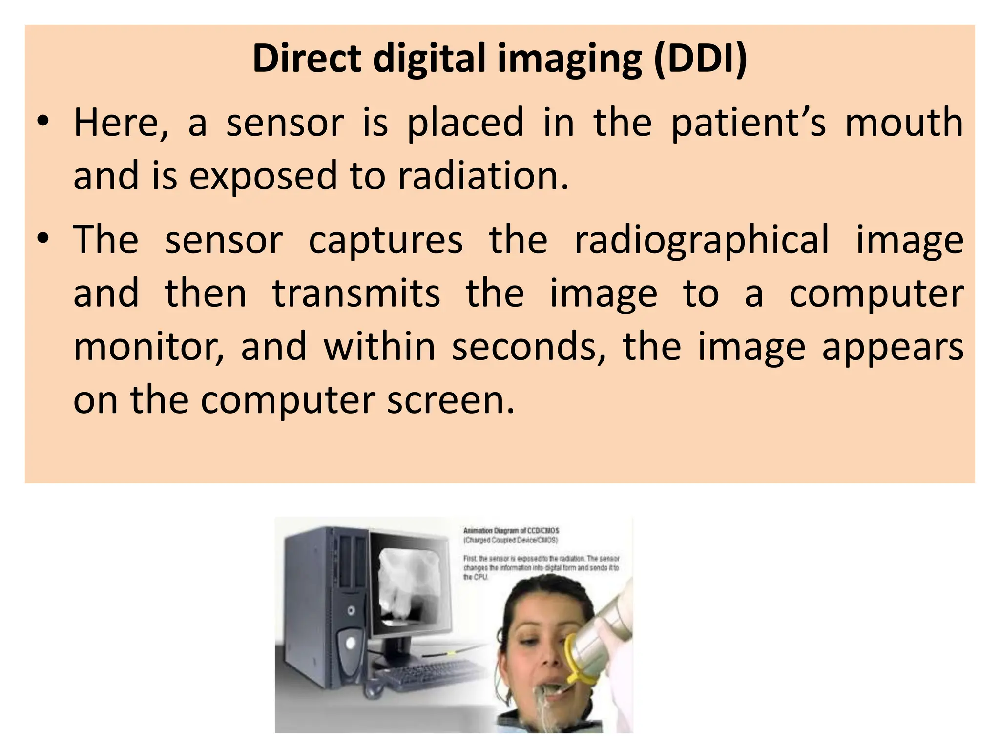 Direct digital imaging (DDI)
• Here, a sensor is placed in the patient’s mouth
and is exposed to radiation.
• The sensor captures the radiographical image
and then transmits the image to a computer
monitor, and within seconds, the image appears
on the computer screen.
 