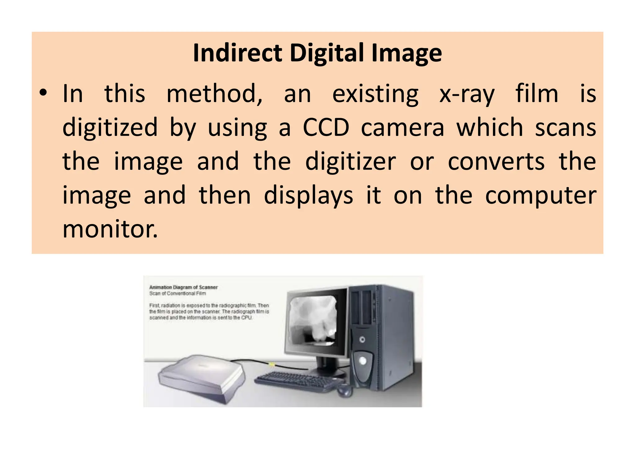 Indirect Digital Image
• In this method, an existing x-ray film is
digitized by using a CCD camera which scans
the image and the digitizer or converts the
image and then displays it on the computer
monitor.
 