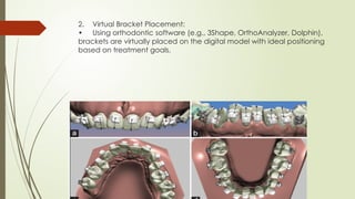 3shape Positioning Guide.pdf Digital Indirect brackets positioning.pptx
