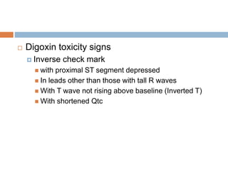  Digoxin toxicity signs
 Inverse check mark
 with proximal ST segment depressed
 In leads other than those with tall R waves
 With T wave not rising above baseline (Inverted T)
 With shortened Qtc
 