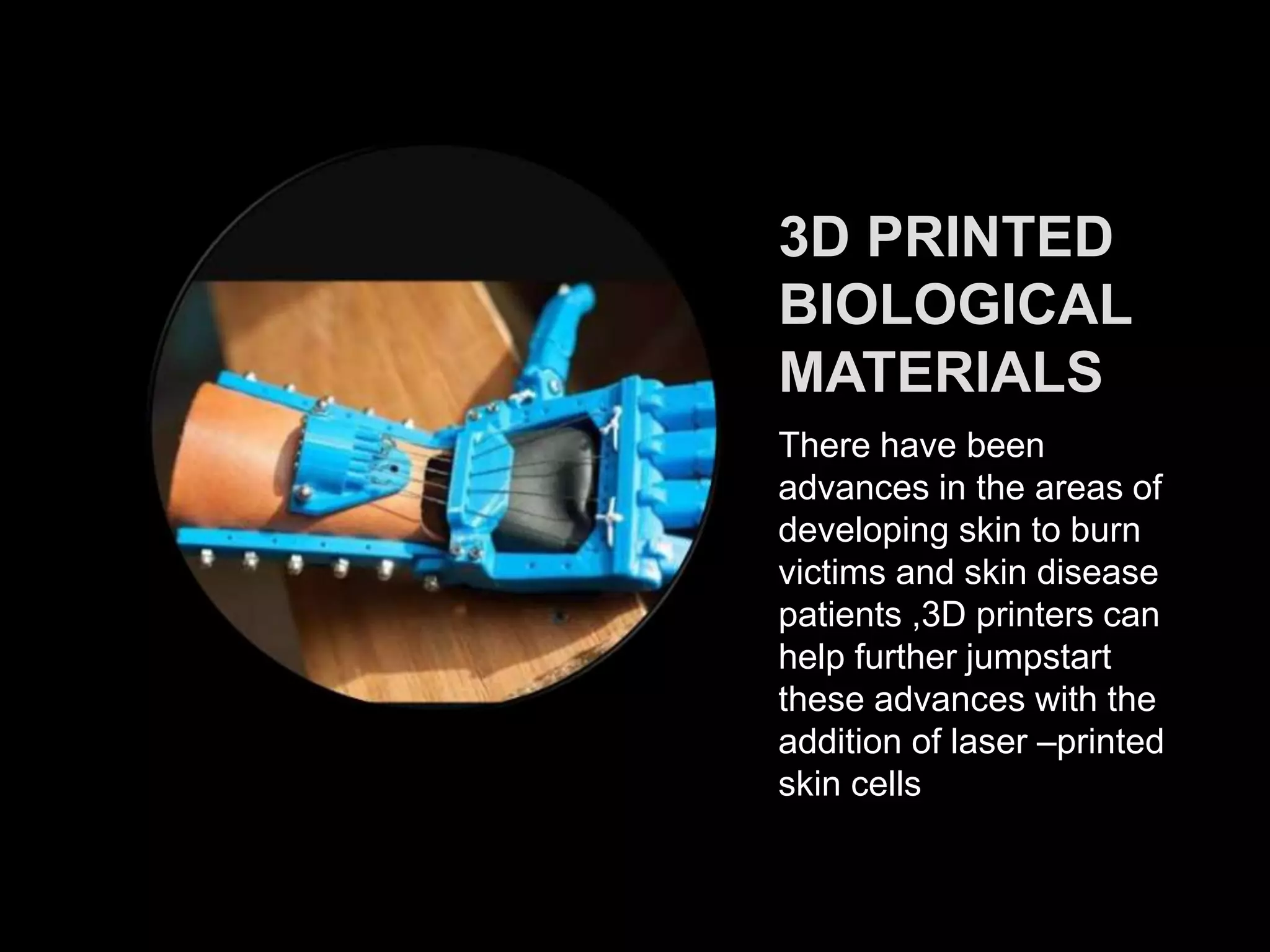 3D PRINTED
BIOLOGICAL
MATERIALS
There have been
advances in the areas of
developing skin to burn
victims and skin disease
patients ,3D printers can
help further jumpstart
these advances with the
addition of laser –printed
skin cells
 