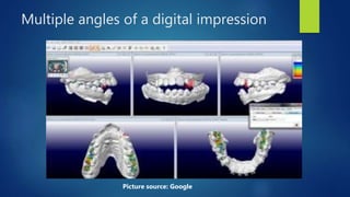 Multiple angles of a digital impression
Picture source: Google
 