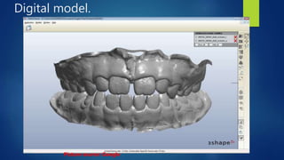 Digital model.
Picture source: Google
 