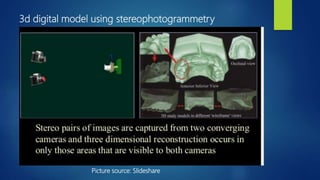 3d digital model using stereophotogrammetry
Picture source: Slideshare
 
