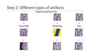 Step 2: Different types of artifacts
 