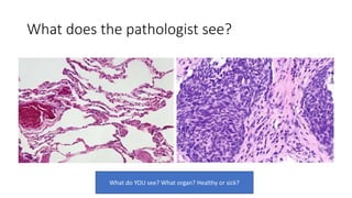 What does the pathologist see?
What do YOU see? What organ? Healthy or sick?
 