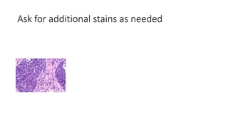 Ask for additional stains as needed
 