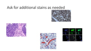 Ask for additional stains as needed
 