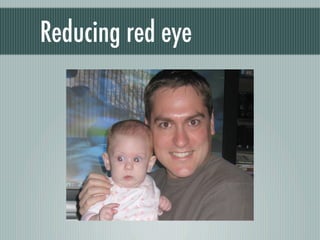 Reducing red eye
 