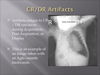 Digital Radiography | PPT