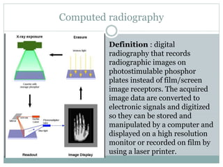 Computed radiography
Definition : digital
radiography that records
radiographic images on
photostimulable phosphor
plates instead of film/screen
image receptors. The acquired
image data are converted to
electronic signals and digitized
so they can be stored and
manipulated by a computer and
displayed on a high resolution
monitor or recorded on film by
using a laser printer.
 
