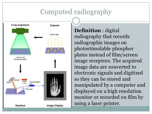 Digital radiography