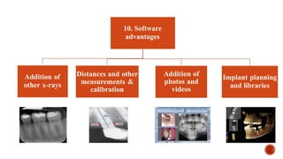 10. Software
advantages
Addition of
other x-rays
Distances and other
measurements &
calibration
Addition of
photos and
videos
Implant planning
and libraries
 