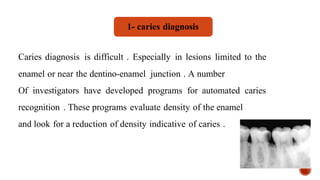 Caries diagnosis is difficult . Especially in lesions limited to the
enamel or near the dentino-enamel junction . A number
Of investigators have developed programs for automated caries
recognition . These programs evaluate density of the enamel
and look for a reduction of density indicative of caries .
1- caries diagnosis
 