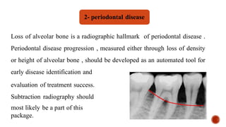 Loss of alveolar bone is a radiographic hallmark of periodontal disease .
Periodontal disease progression , measured either through loss of density
or height of alveolar bone , should be developed as an automated tool for
early disease identification and
evaluation of treatment success.
Subtraction radiography should
most likely be a part of this
package.
2- periodontal disease
 