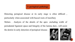 Detecting periapical disease at its early stage is often difficult ,
particularly when associated with buccal roots of maxillary
Molars . Analysis of the details of the apex ,including width of
periodontal ligament space and Integrity of the lamina dura , will assist
the dentist in early detection of periapical disease .
3- periapical pathology
 