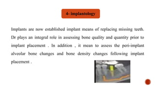 Implants are now established implant means of replacing missing teeth.
Dr plays an integral role in assessing bone quality and quantity prior to
implant placement . In addition , it mean to assess the peri-implant
alveolar bone changes and bone density changes following implant
placement .
4- implantology
 