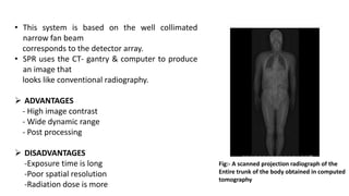 DIGITAL RADIOGRAPHY-SABBU KHATOON .pptx