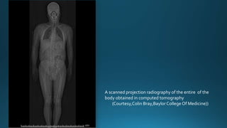A scanned projection radiography of the entire of the
body obtained in computed tomography
(Courtesy,Colin Bray,Baylor College Of Medicine))
 