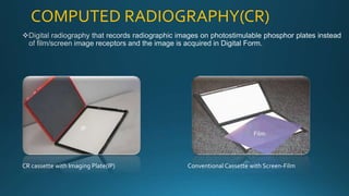 COMPUTED RADIOGRAPHY(CR)
CR cassette with Imaging Plate(IP) Conventional Cassette with Screen-Film
IP
Screen
Film
 