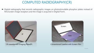 Digital radiography-Avinesh Shrestha | PPTX