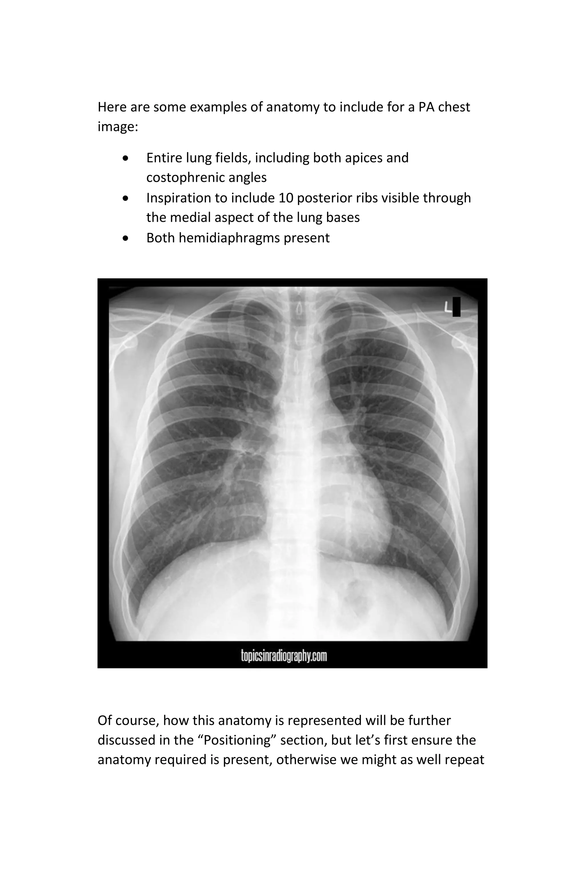 Here are some examples of anatomy to include for a PA chest
image:
 Entire lung fields, including both apices and
costophrenic angles
 Inspiration to include 10 posterior ribs visible through
the medial aspect of the lung bases
 Both hemidiaphragms present
Of course, how this anatomy is represented will be further
discussed in the “Positioning” section, but let’s first ensure the
anatomy required is present, otherwise we might as well repeat
 