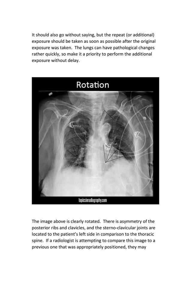 Digital Radiography Image Critique | PDF
