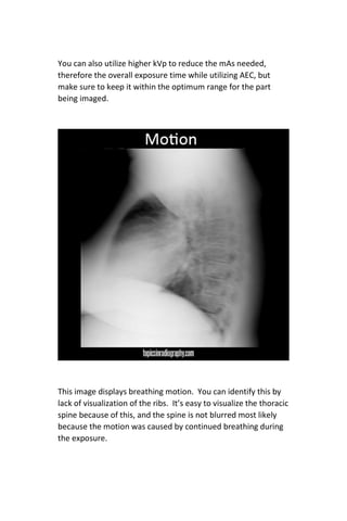 Digital Radiography Image Critique | PDF