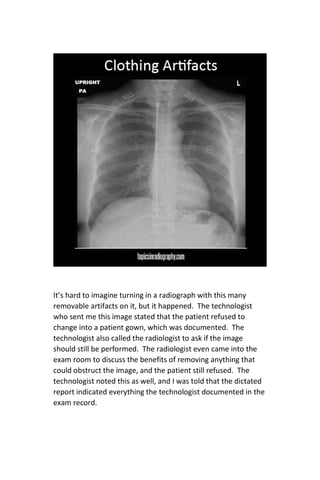 Digital Radiography Image Critique | PDF