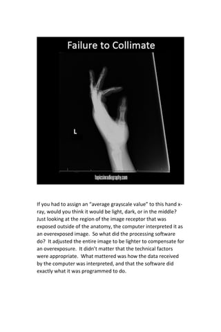 Digital Radiography Image Critique | PDF