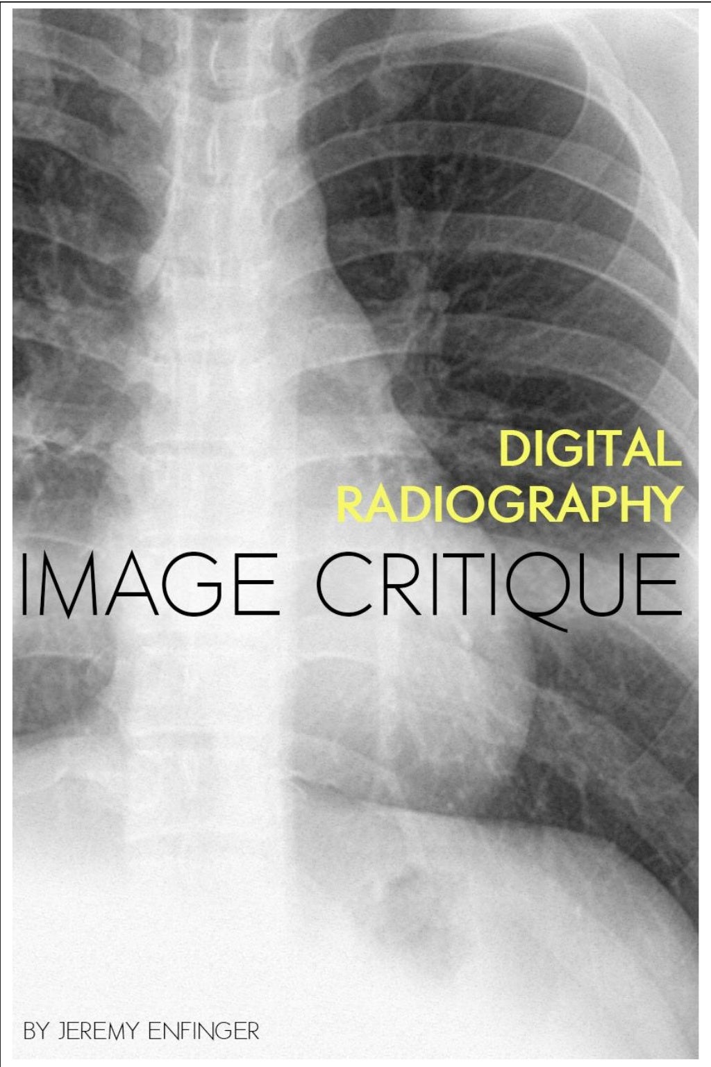 Digital Radiography Image Critique