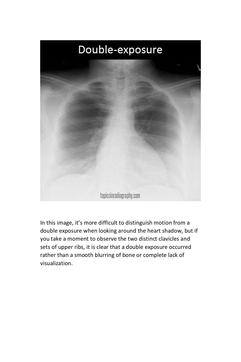 Digital radiography thesis picture